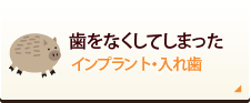 歯をなくしてしまった インプラント・入れ歯