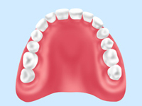 保険の入れ歯